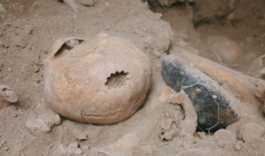Tracce di 'chirurgia cerebrale' su crani risalenti a 3.200 anni fa a Van
