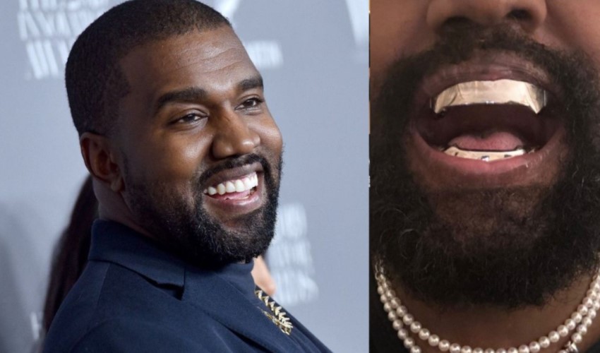 Kanye West diş implantı yaptırdı: 850 bin dolar ödedi
