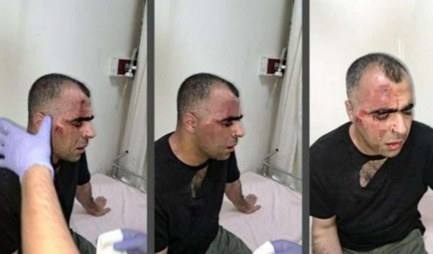 Saldırıya uğramıştı: Gazeteci Sinan Aygül'e hapis cezası