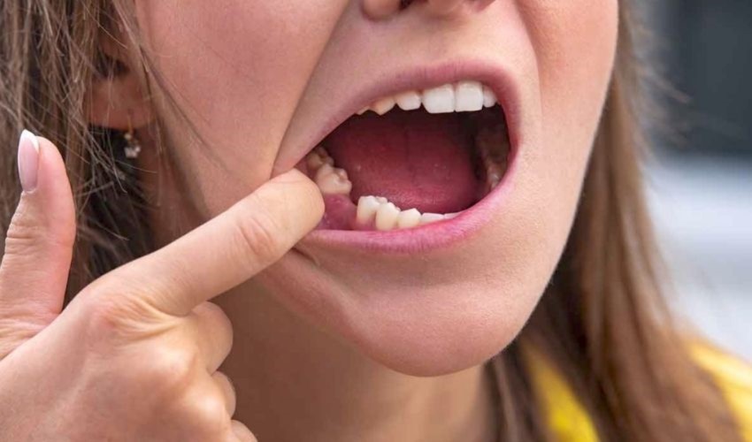 Diş Sağlığı: Dişleri Ömür Boyu Korumanın Püf Noktaları