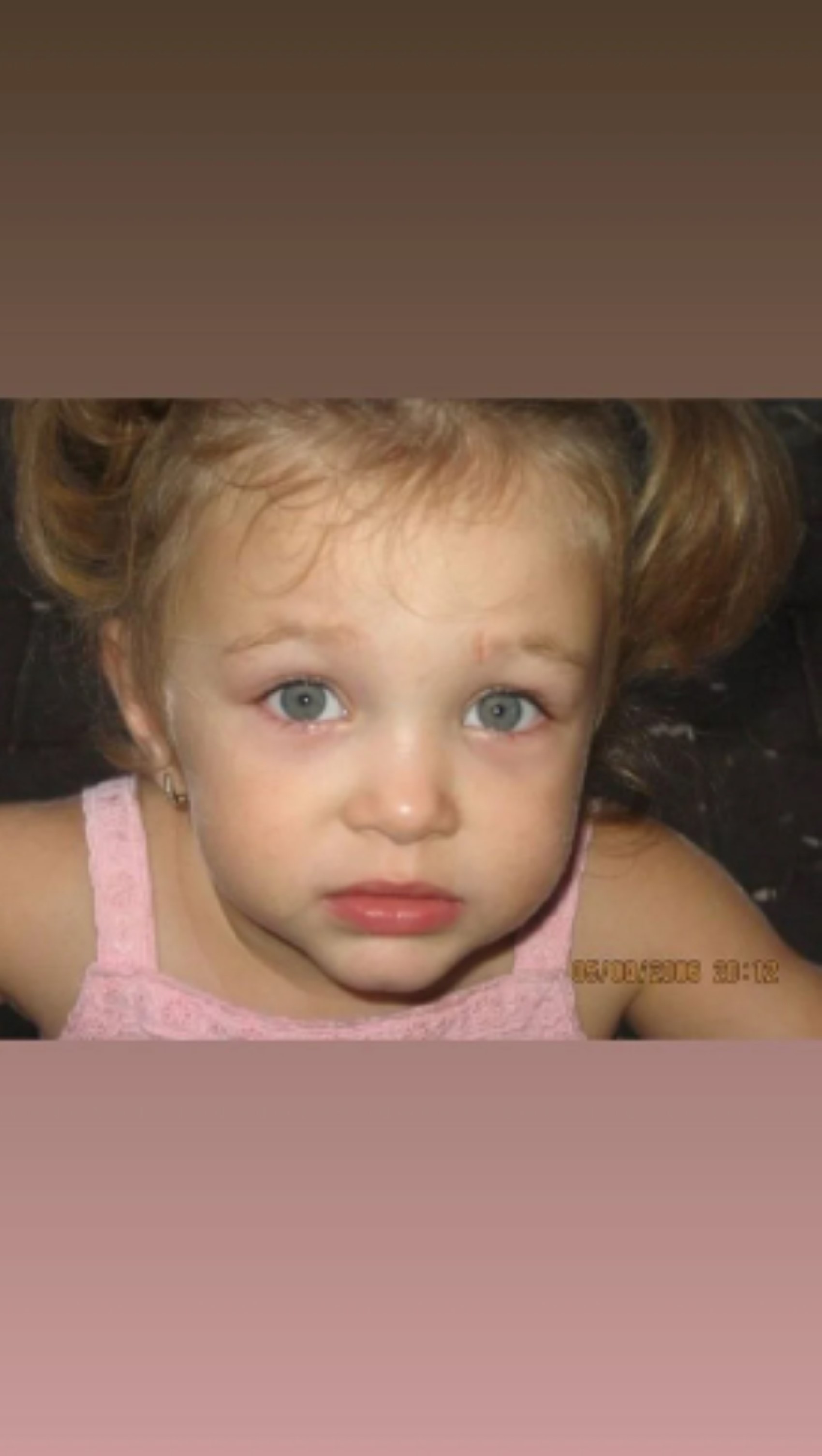 Risponde alle critiche sulla chirurgia estetica! Ayliz Duman condivide le sue foto da bambina