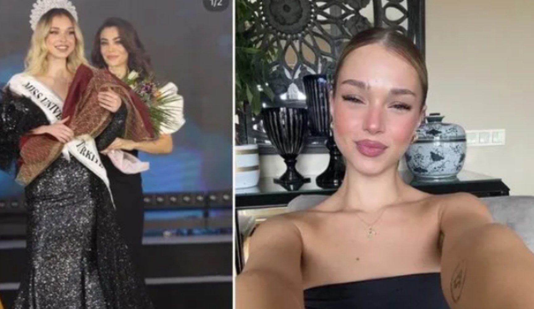 Risponde alle critiche sulla chirurgia estetica! Ayliz Duman condivide le sue foto da bambina