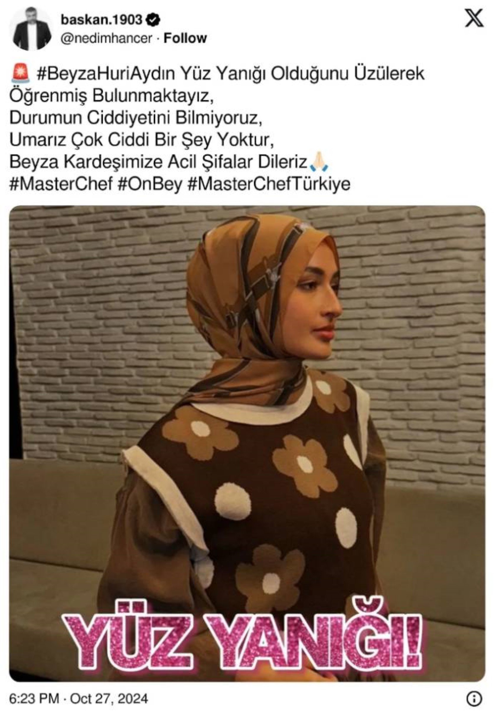 MasterChef Beyza’nın kaza geçirdiği iddia edildi!