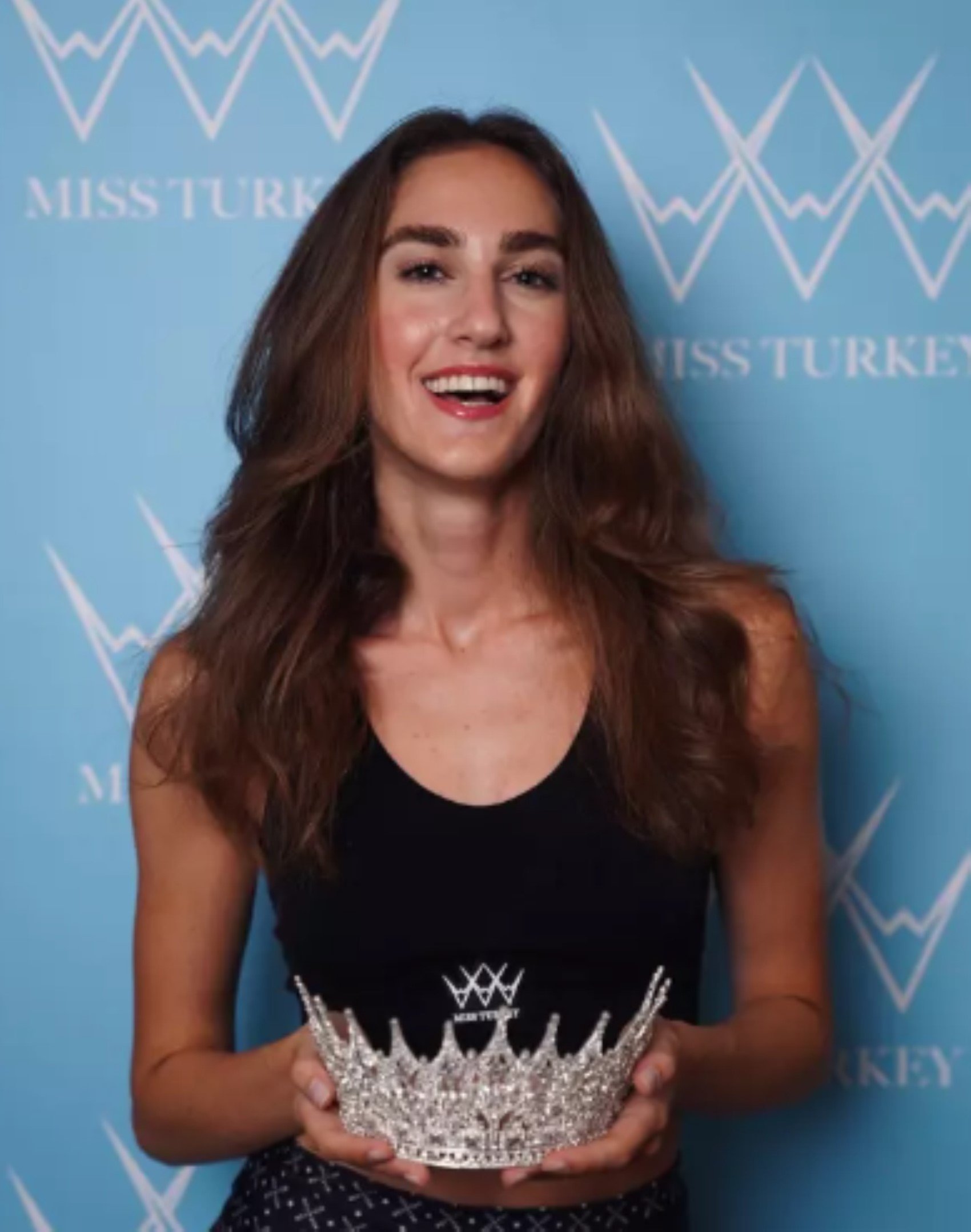 Miss Turkey güzeli İdil Bilgen'den yeni paylaşım! Estetik mi yaptırdı? O detay dikkatlerden kaçmadı