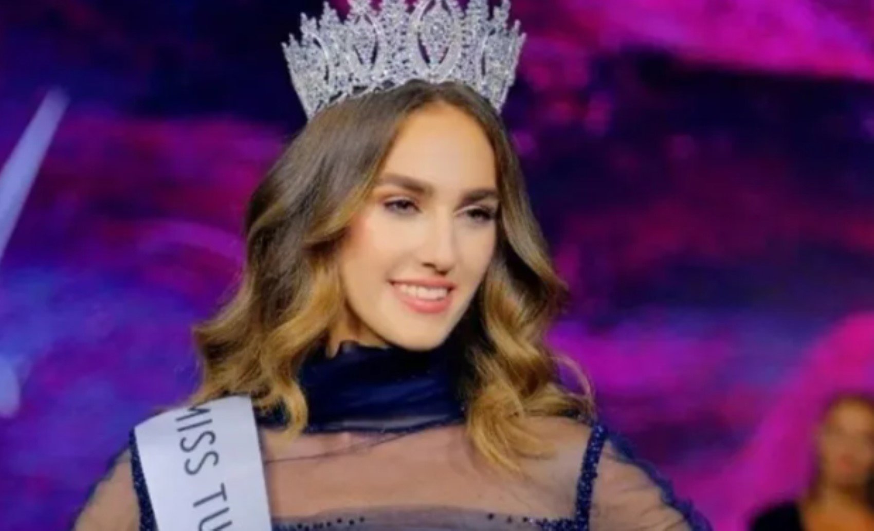 Miss Turkey güzeli İdil Bilgen'den yeni paylaşım! Estetik mi yaptırdı? O detay dikkatlerden kaçmadı