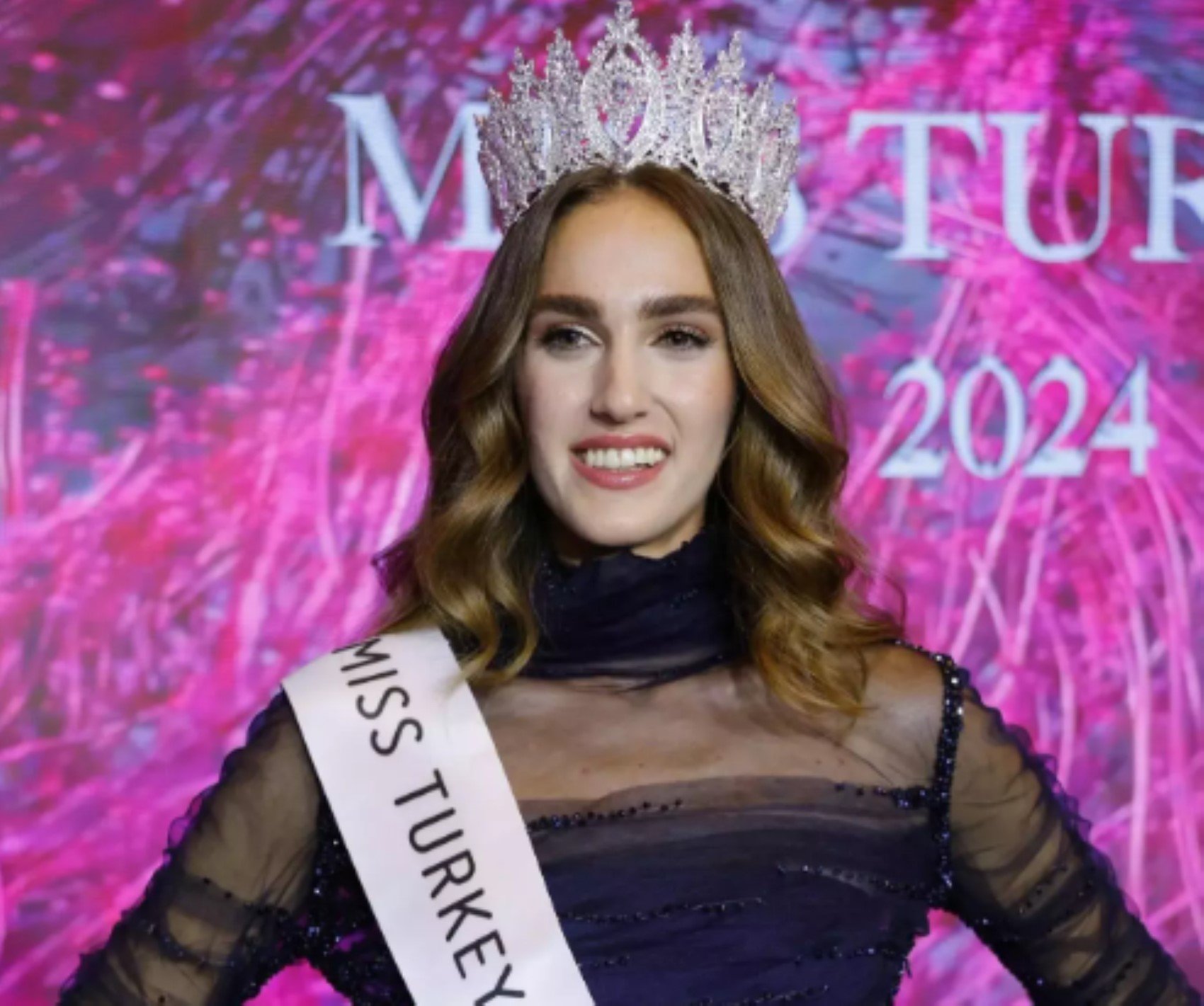 Miss Turkey güzeli İdil Bilgen'den yeni paylaşım! Estetik mi yaptırdı? O detay dikkatlerden kaçmadı