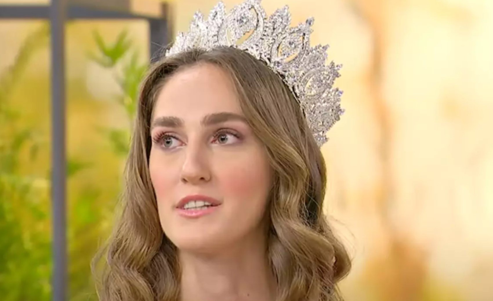 Miss Turkey güzeli İdil Bilgen'den yeni paylaşım! Estetik mi yaptırdı? O detay dikkatlerden kaçmadı