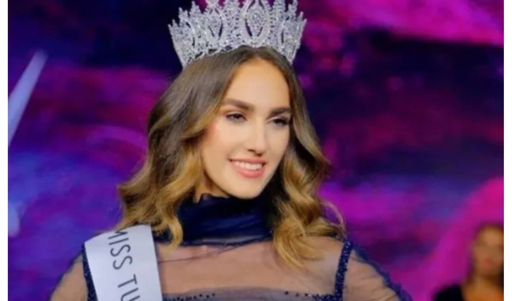 Miss Turkey güzeli İdil Bilgen'den yeni paylaşım! Estetik mi yaptırdı? O detay dikkatlerden kaçmadı