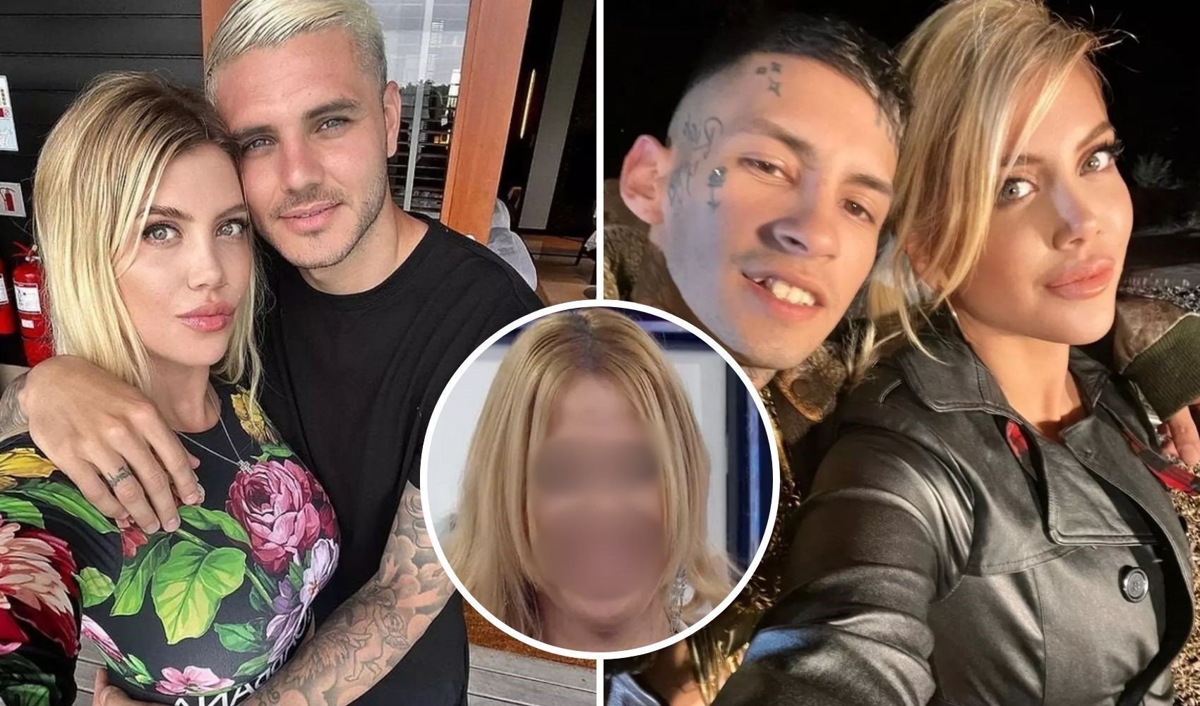 Wanda Nara'nın estetiksiz hali olay oldu! Değişimi ağızları açıkta bıraktı