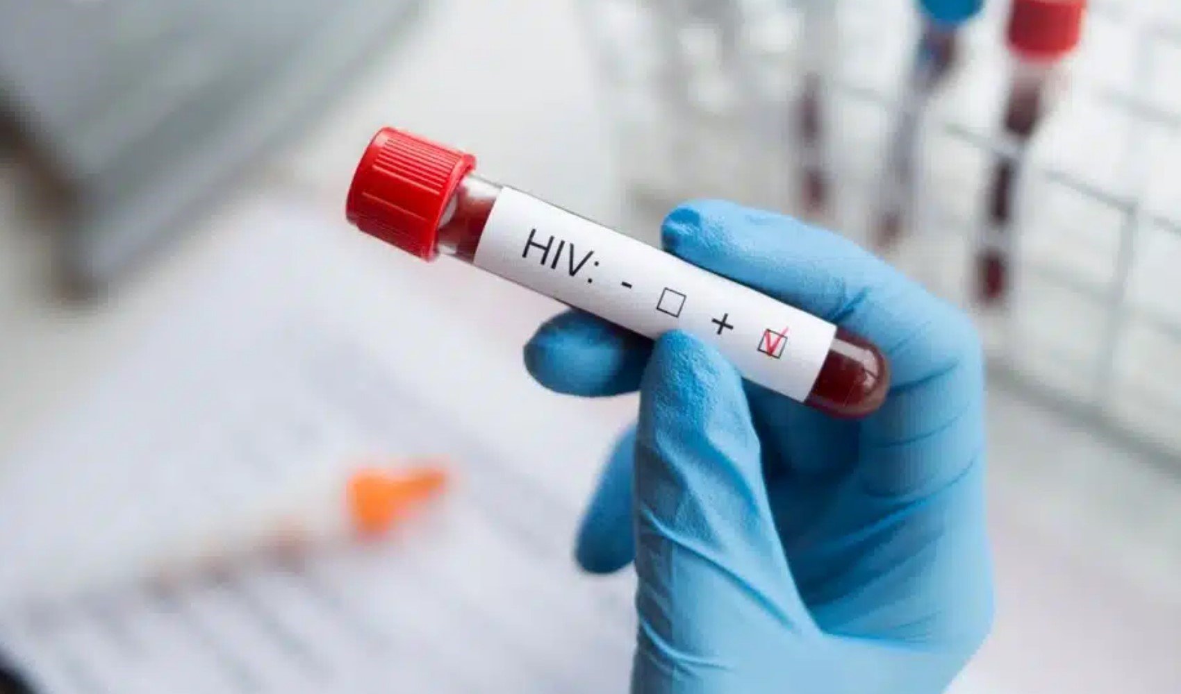 İzmir’de 13 yaşındaki çocuk AIDS’ten hayatını kaybetti: 'Türkiye'de 250’ye yakın HIV pozitif çocuk var'