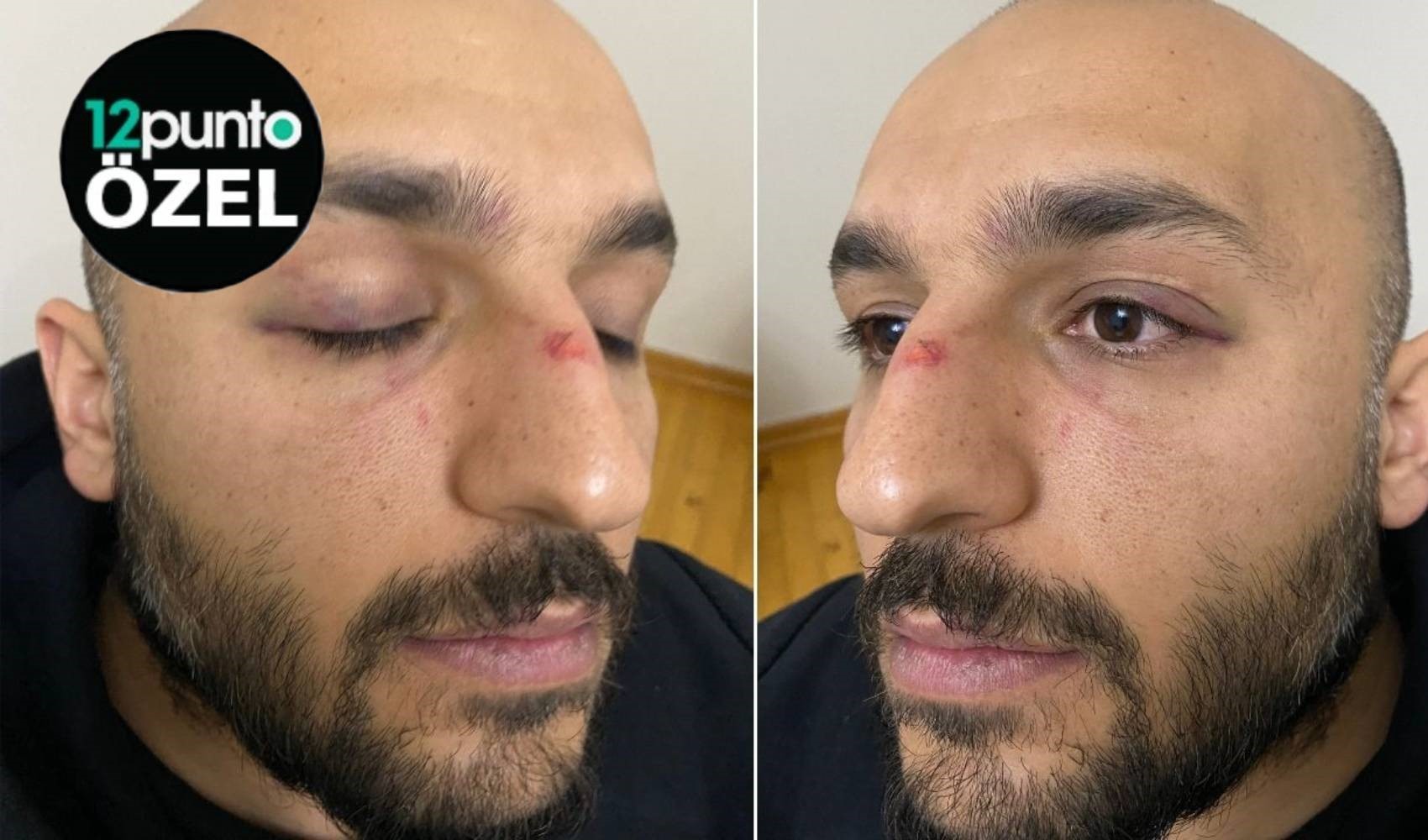 24 Kasım Öğretmenler Günü’nde utanç haberi: Patrondan eğitimciye yumruklu saldırı!