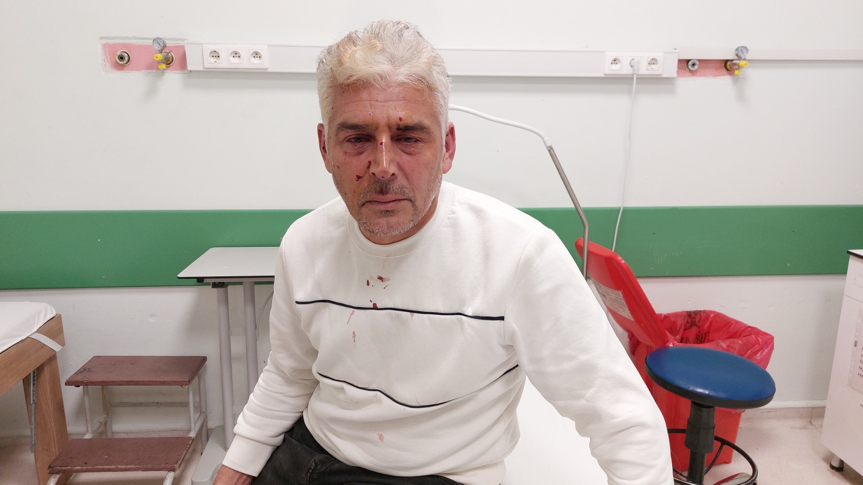Lite per un toast finisce in sparatoria: ha usato un fucile a pompa