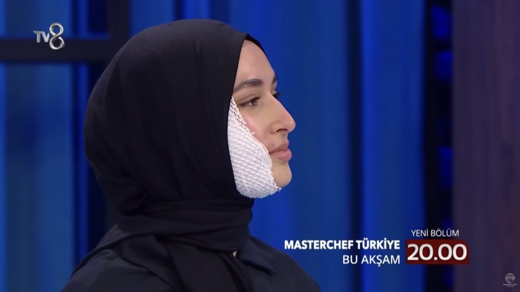 Yüzüne kızgın yağ dökülmüştü: MasterChef Türkiye'de Beyza sürprizi! Yarışmaya devam edecek mi?