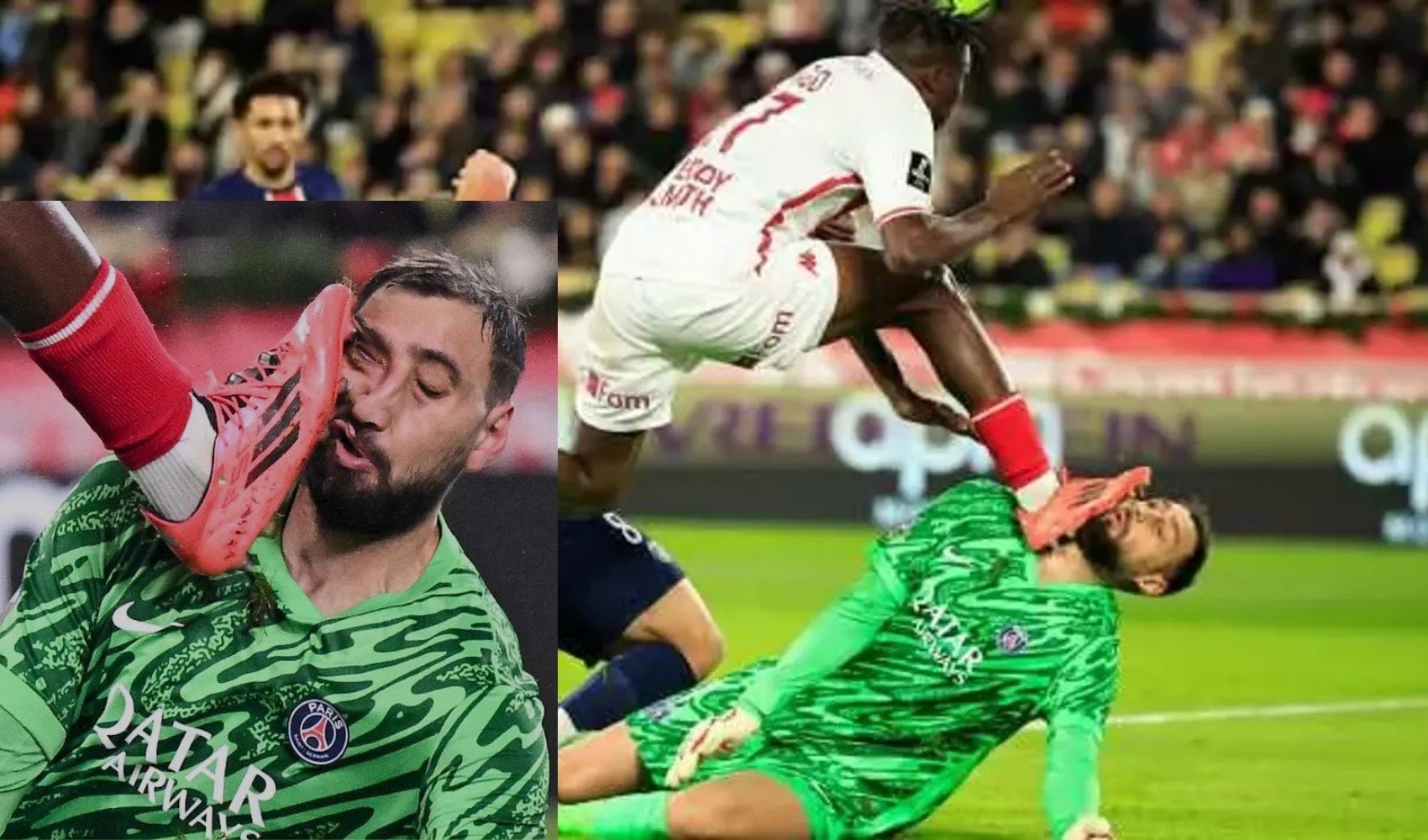 Monaco-PSG maçında korkunç müdahele: Ünlü futbolcunun yüzü parçalandı, kart bile çıkmadı