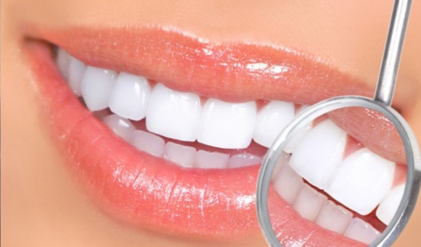 Dişleri ömür boyu korumanın yolları