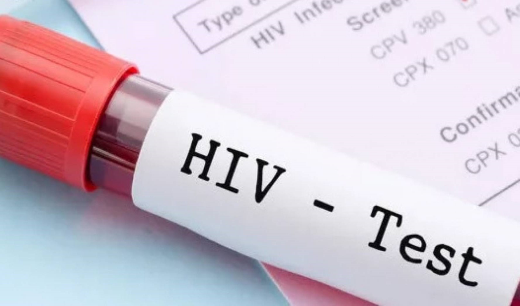 AIDS (HIV) nedir, nasıl bulaşır, tedavisi var mı?