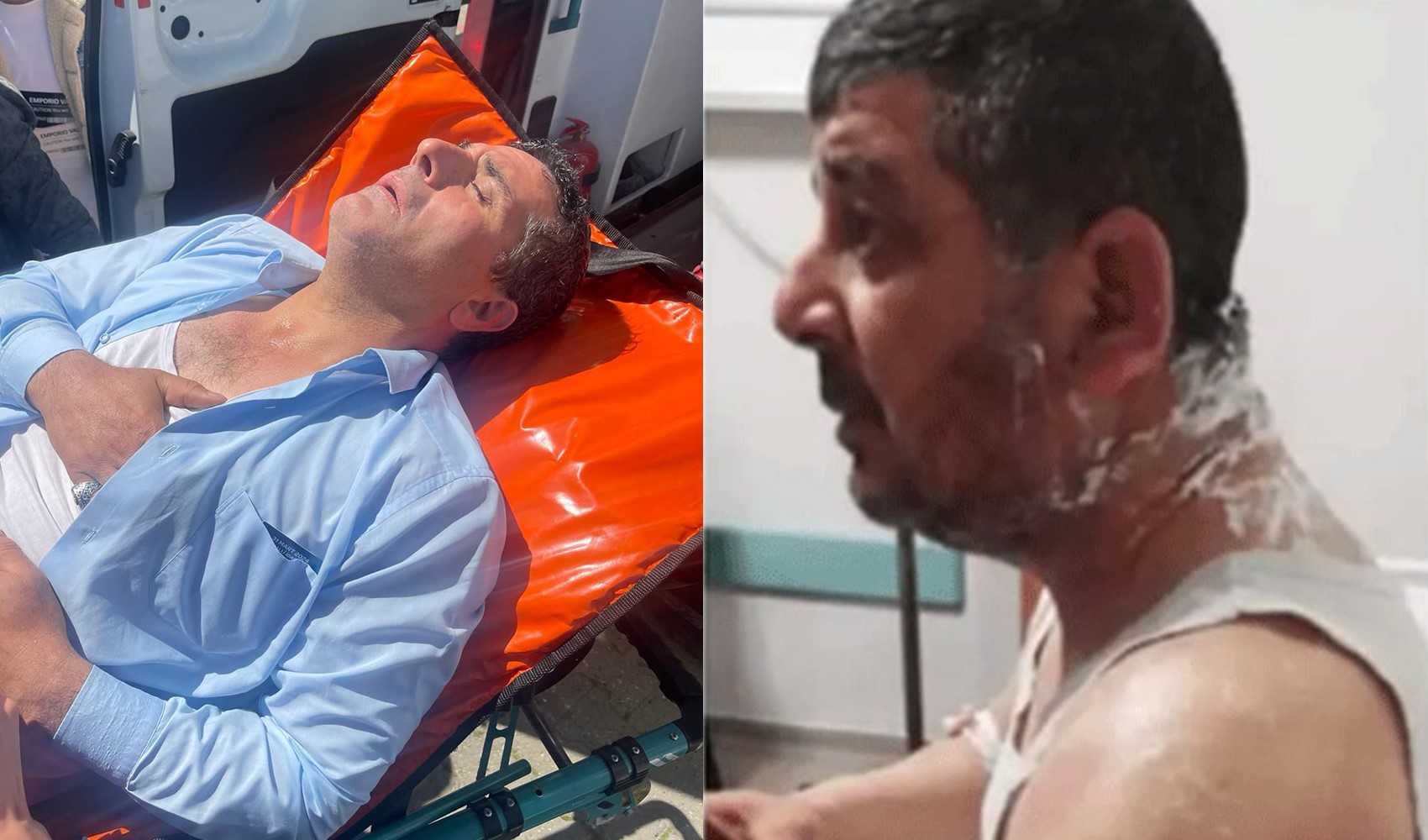 DP'li Ertan Küçükay paylaştı: Meclis üyesi adayının yüzüne asit atıldı