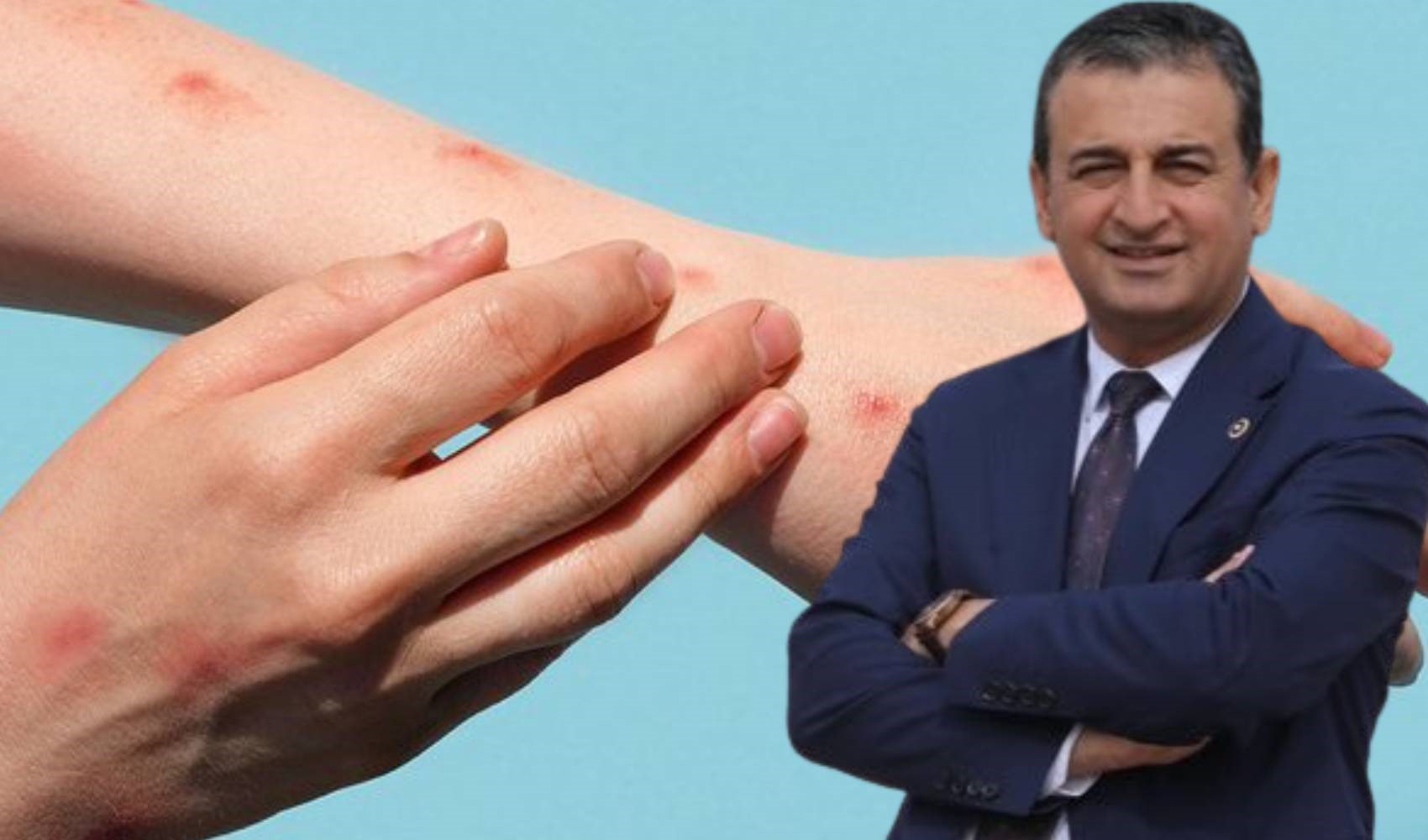 CHP'li Bulut'tan Bakan Memişoğlu'na 'Mpox' sorusu: 'Eylem planınız var mı?'