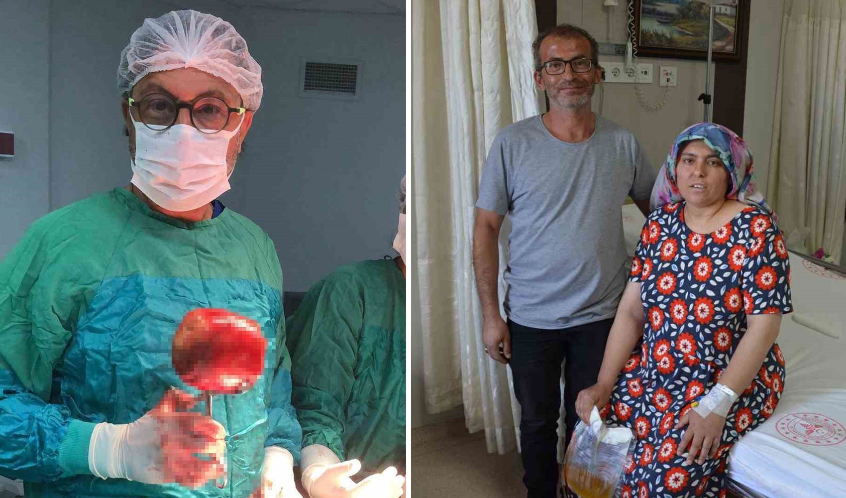 Karın ağrısı şikayetiyle gitti, mesanesinden 1 kilogramlık taş çıkarıldı