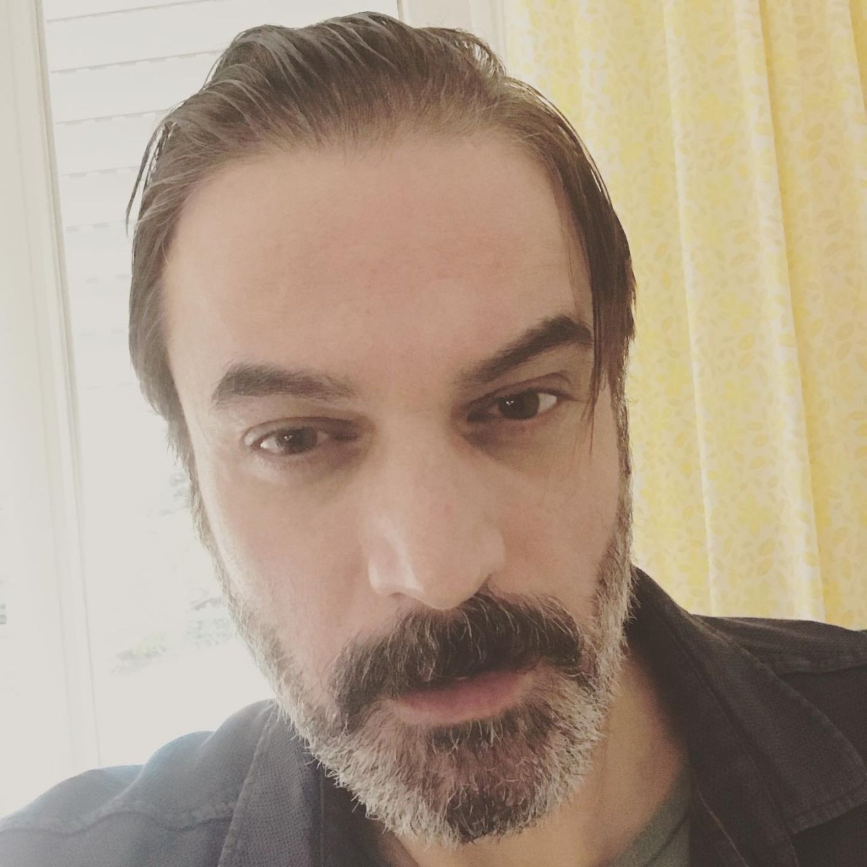 Zor günleri geride bıraktı: Ufuk Özkan'dan yoğun bakım sonrası ilk görüntü