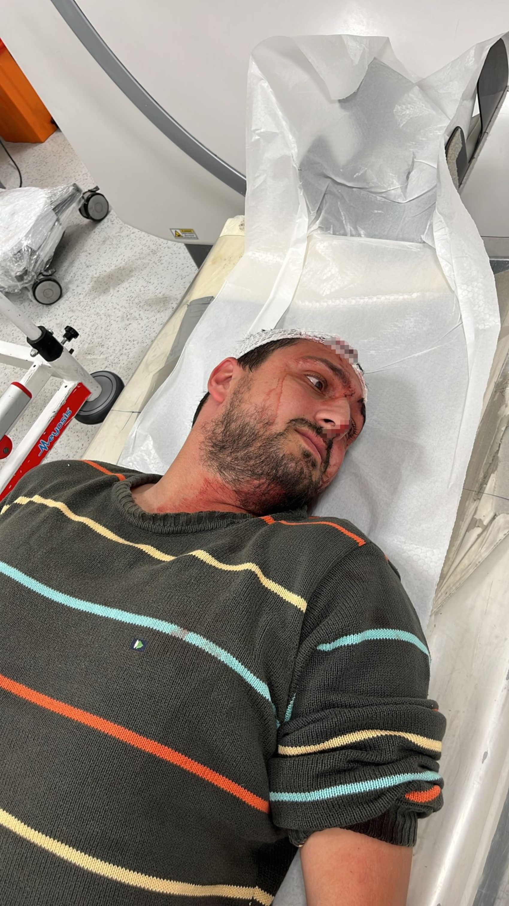 Otizmli şahıs odunluğa baktı diye odunla darbedildi