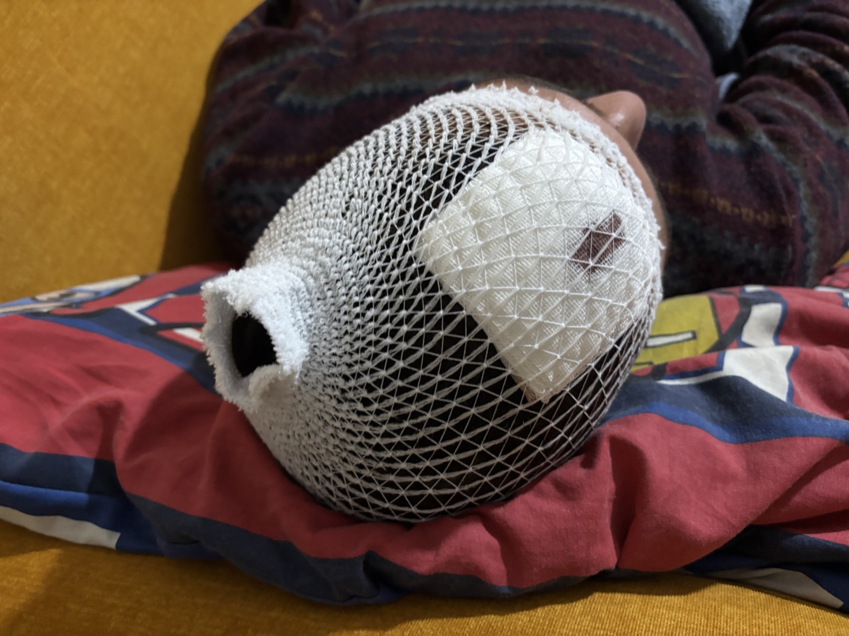 Otizmli şahıs odunluğa baktı diye odunla darbedildi