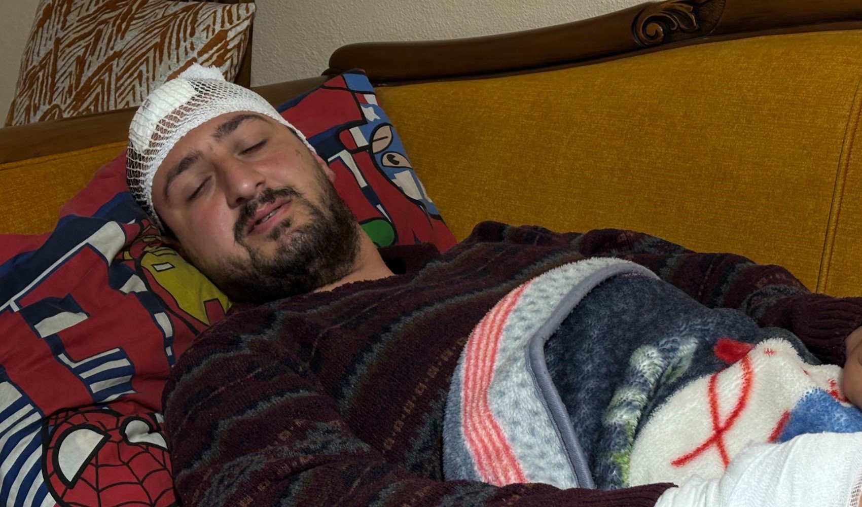 Otizmli şahıs odunluğa baktı diye odunla darbedildi