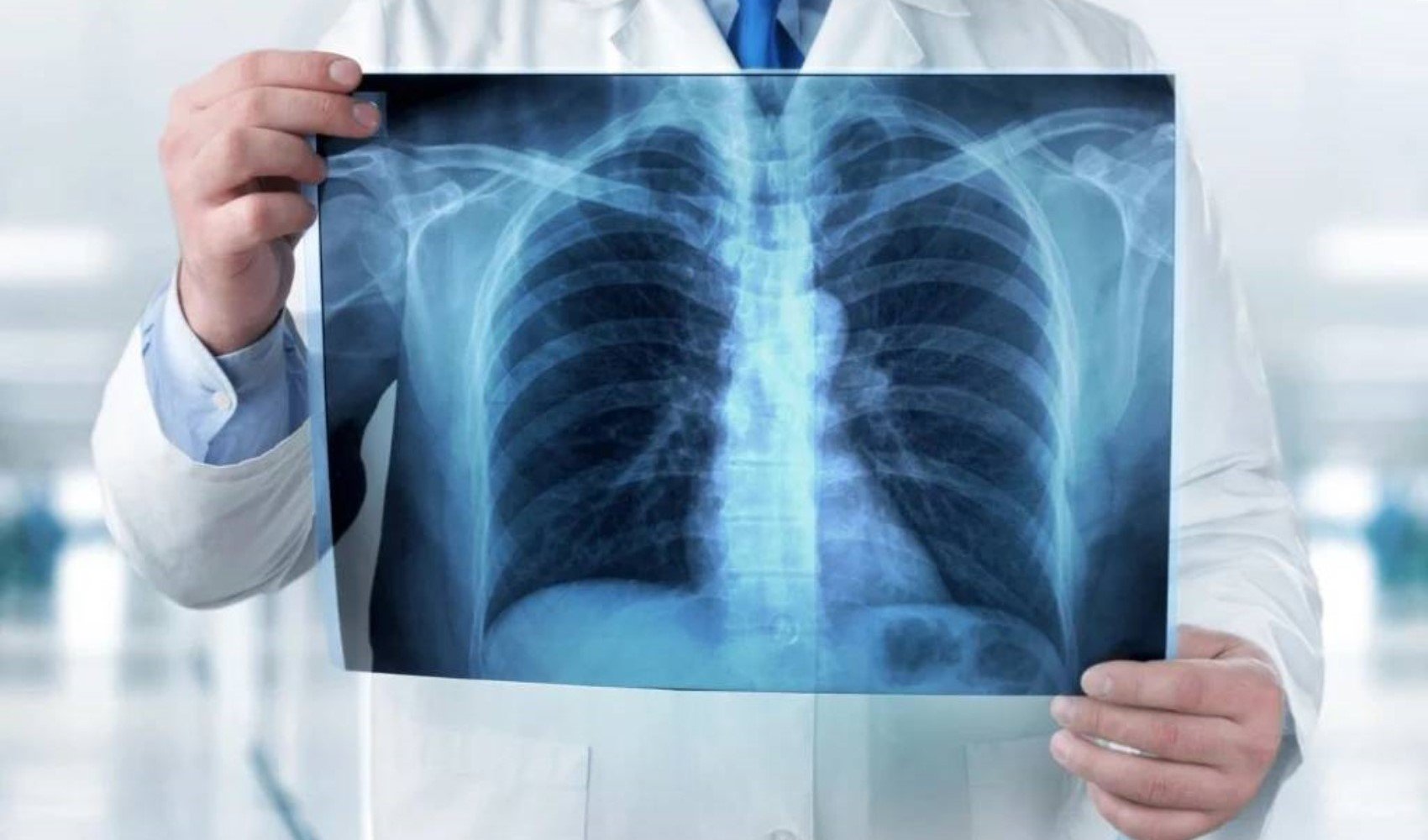 Akciğerlerimizi yaşlandıran beş önemli etken ve akciğer sağlığını korumak için yapılması gerekenler