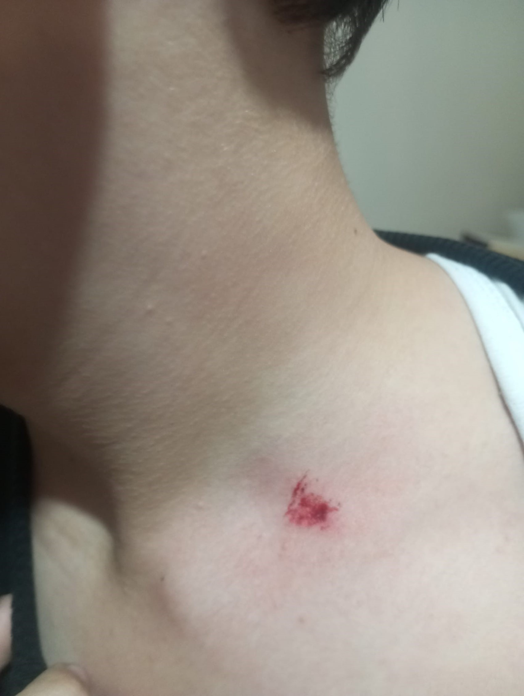 Antalya'da 7'nci sınıf öğrencisine akran zorbalığı iddiası