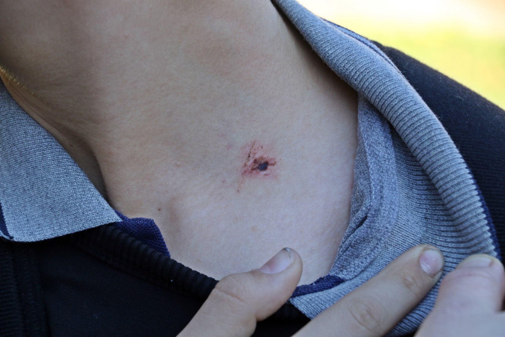 Antalya'da 7'nci sınıf öğrencisine akran zorbalığı iddiası