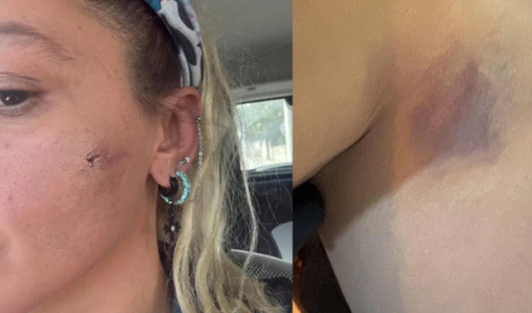 Yıldız Asyalı: Kocam tarafından darp edildim