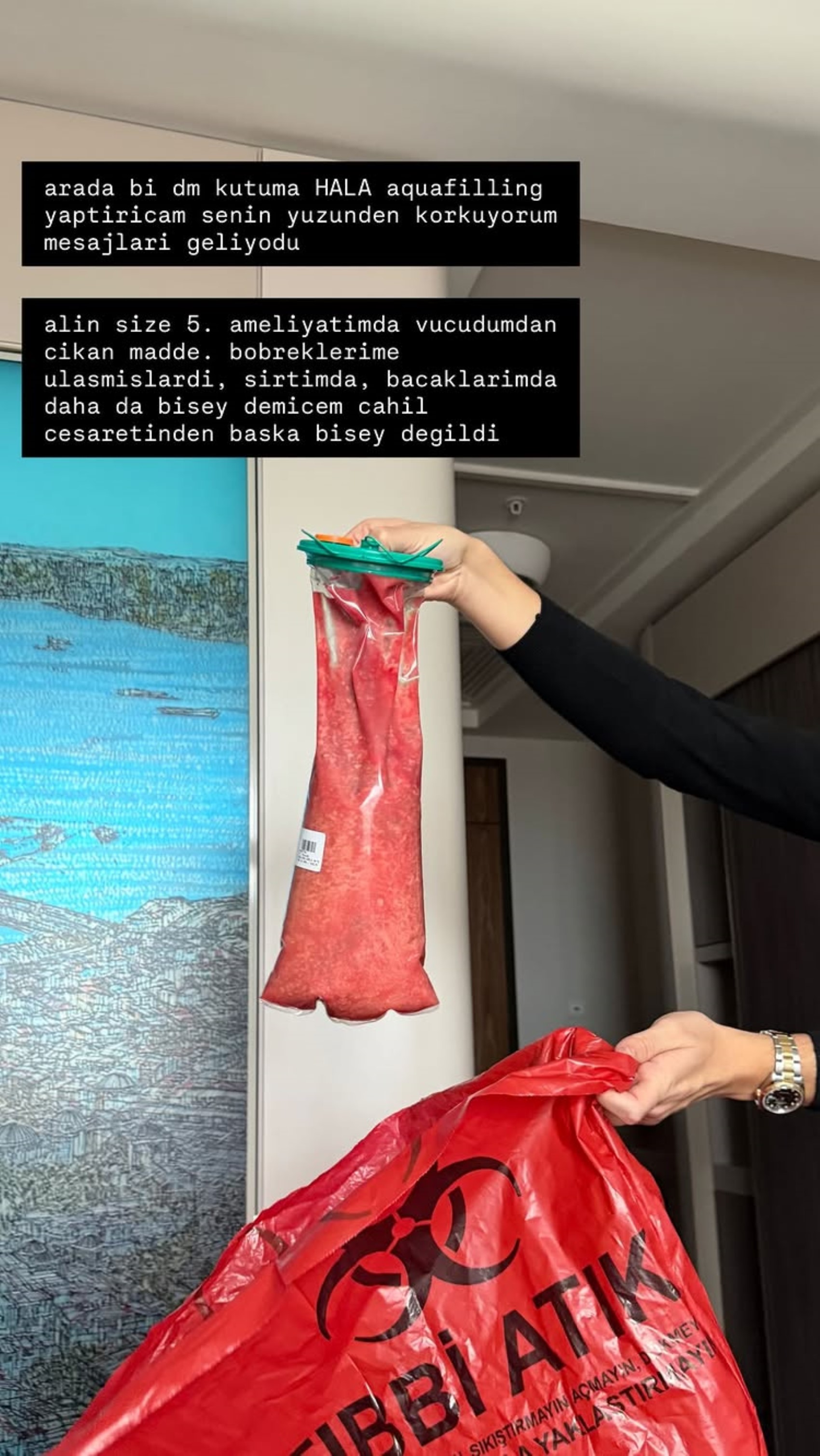 Danla Bilic’in 5. ameliyatından çıkan madde şoke etti! Takipçilerini uyardı: 'Yaptırmayın'