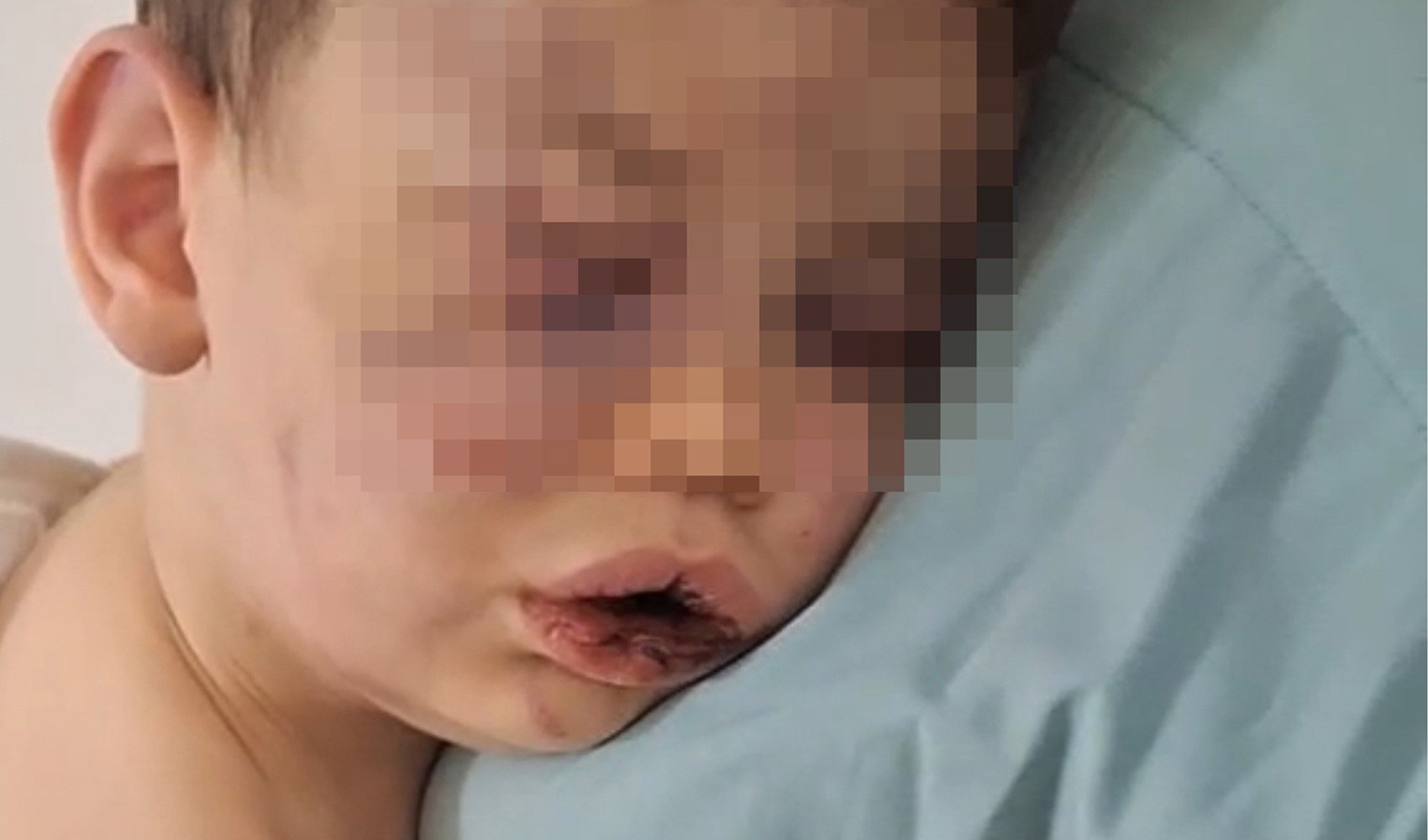 Darp sonucu hastanelik olan bebek devlet korumasına alınacak