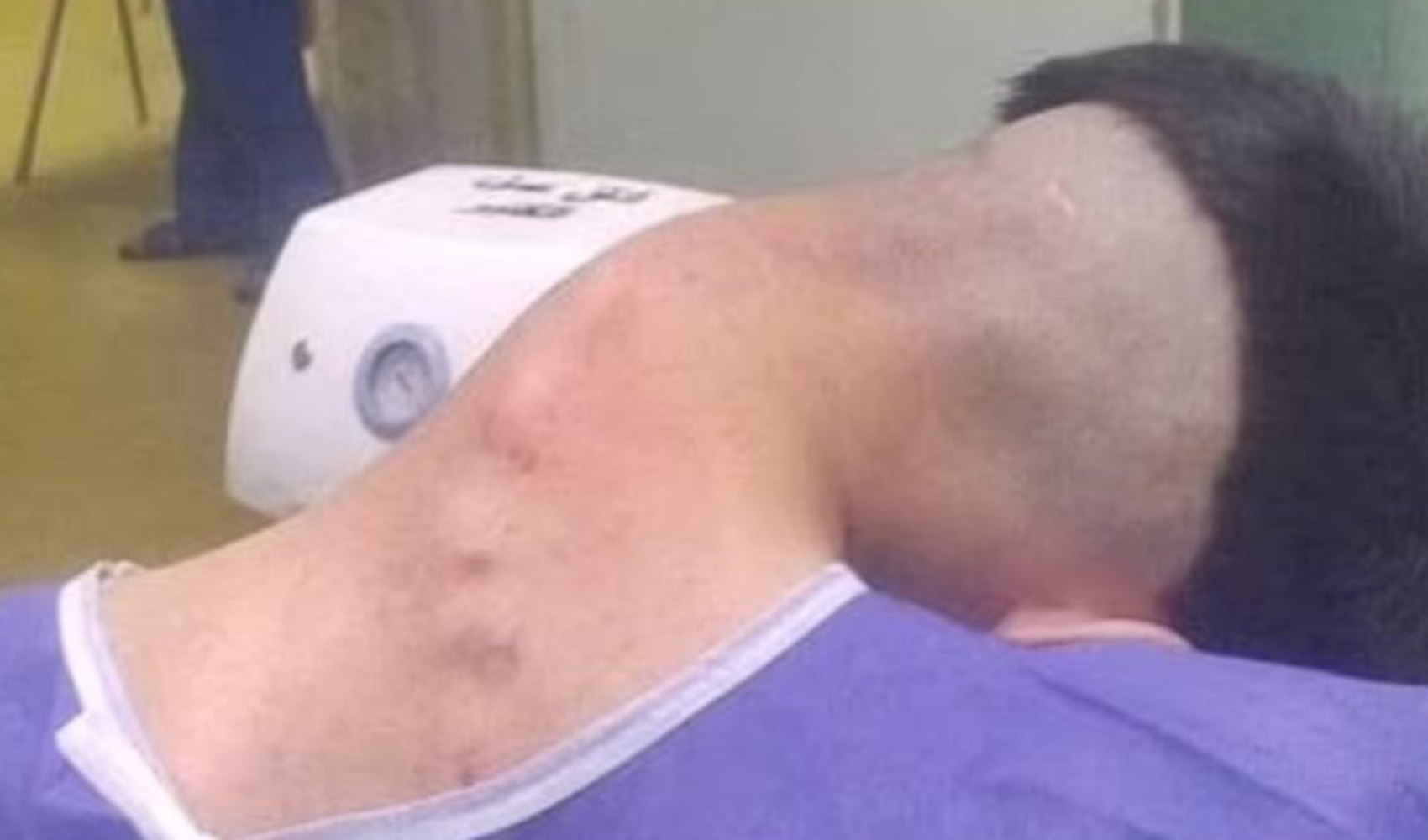 Uyuşturucu bağımlısının boynu başını taşıyamadı Uyuşturucu bağımlısının boynu başını taşıyamadı