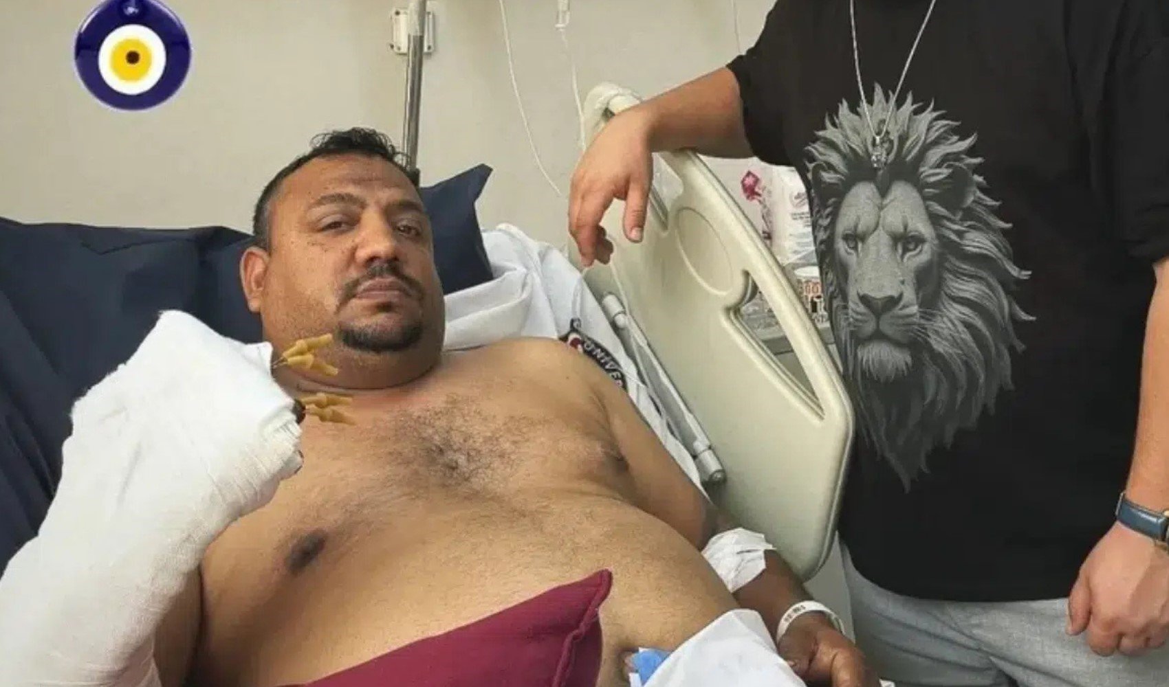 Şampiyonluk gecesi kutlamasıyla tanınmıştı: Kadir Ircı parmaklarını kaybetti