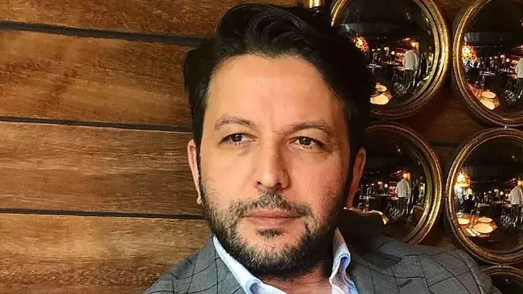 Görenler inanamadı... Nihat Doğan estetik yaptırdı: Sosyal medyada büyük ilgi gördü