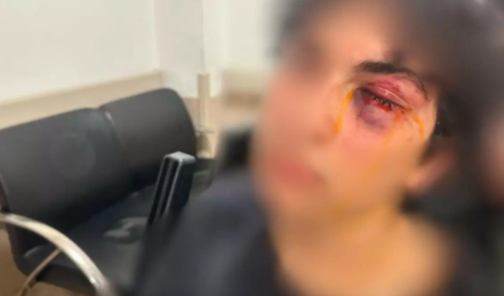 Kadıköy’de CHP standına saldırı! 15 yaşındaki genç hastanelik oldu