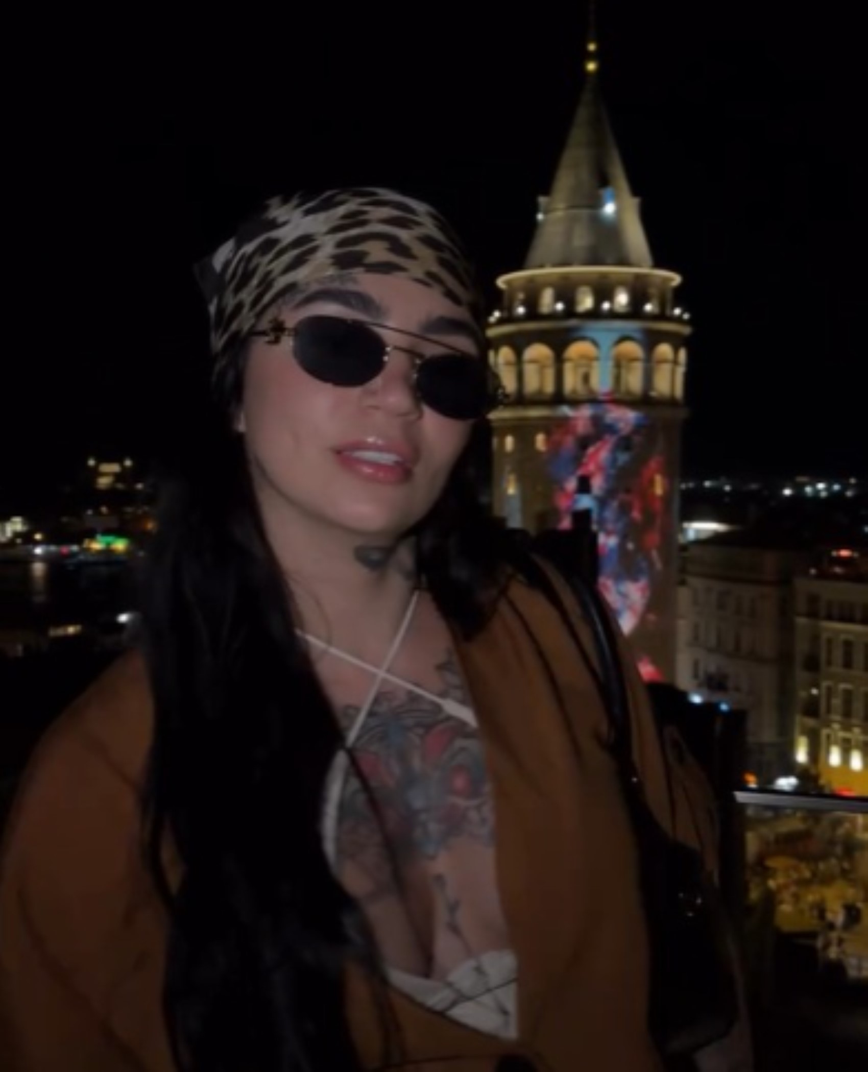 İstanbul’da estetik ameliyat sonrası trajedi: Ünlü fenomen Ana Bárbara hayatını kaybetti