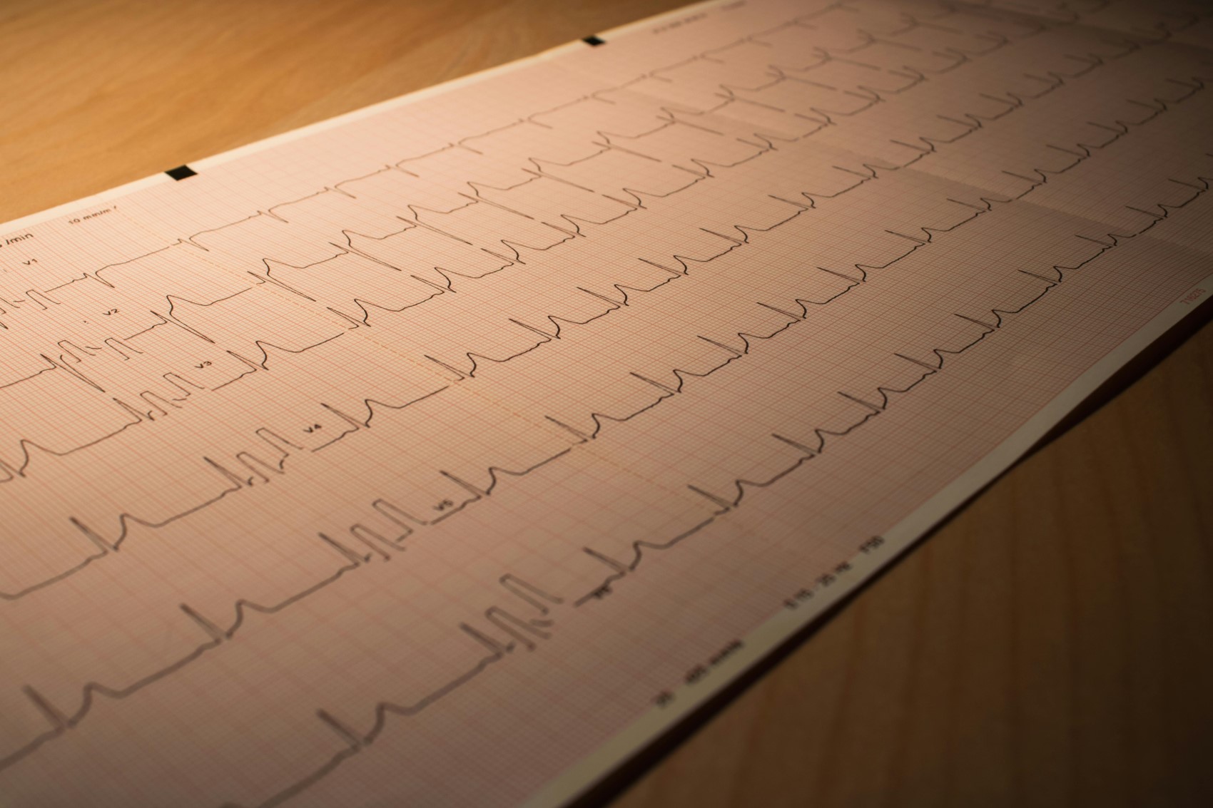 Kırmızı alarm: Kadın kalp sağlığı için harekete geçme zamanı