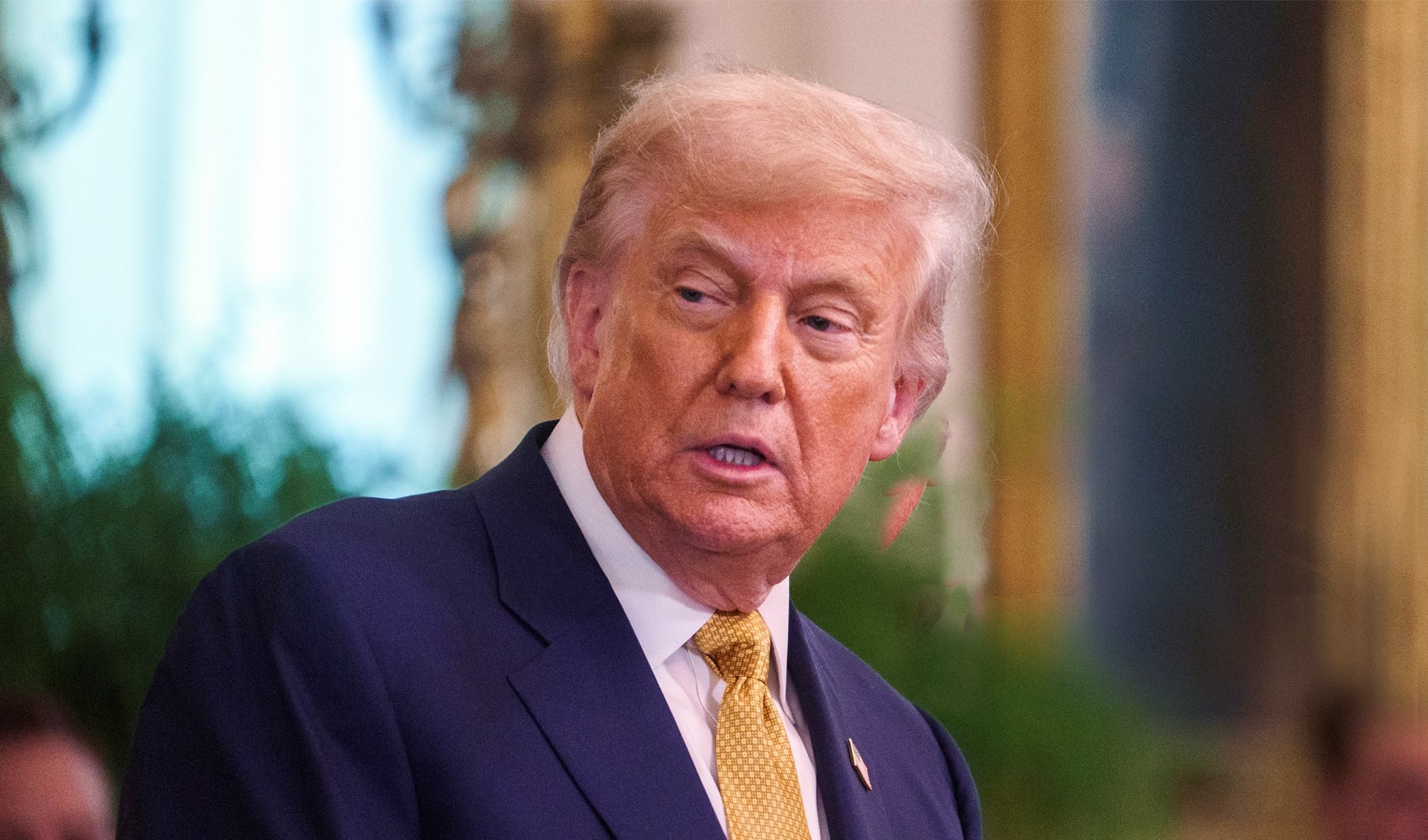 Trump'a 'kronik venöz yetmezlik' teşhisi konuldu