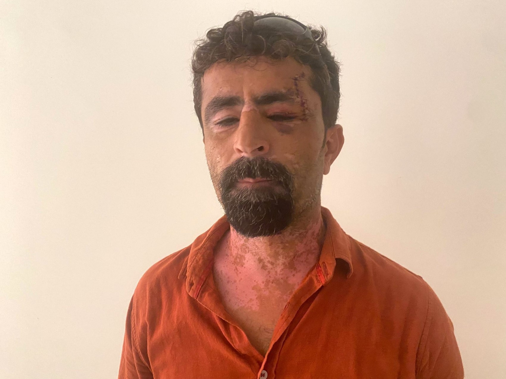 Öfkeli damat kayınpederini hastanelik etti