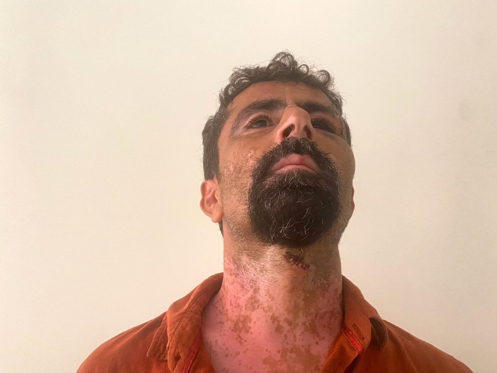 Öfkeli damat kayınpederini hastanelik etti