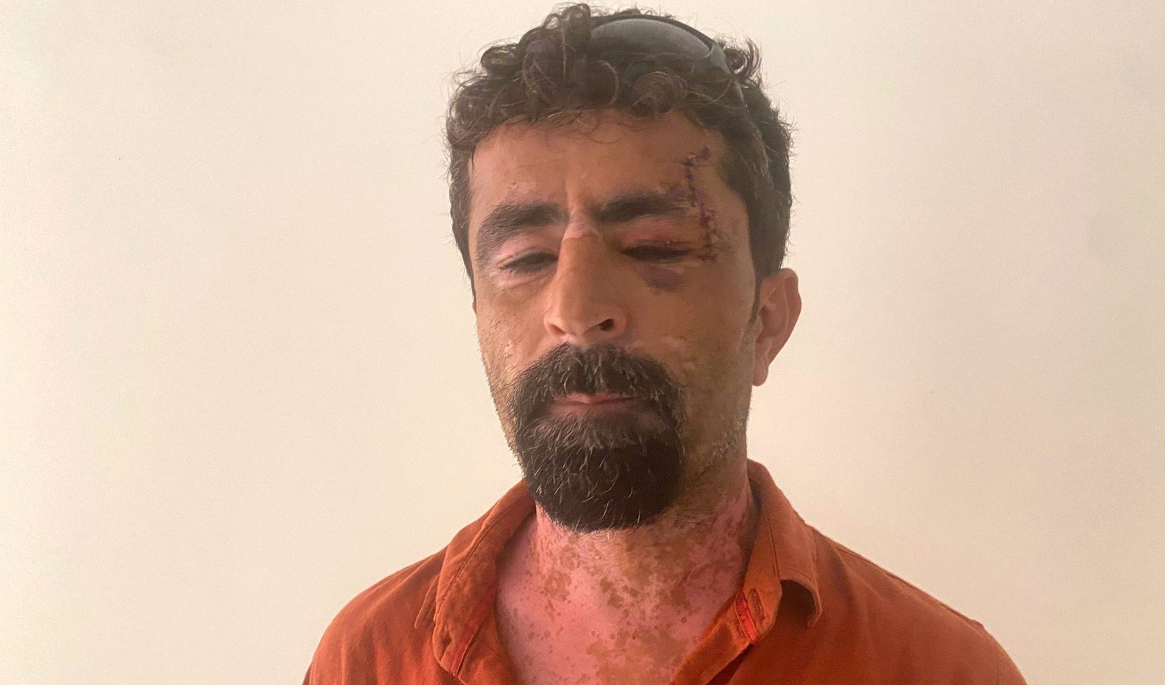 Öfkeli damat kayınpederini hastanelik etti