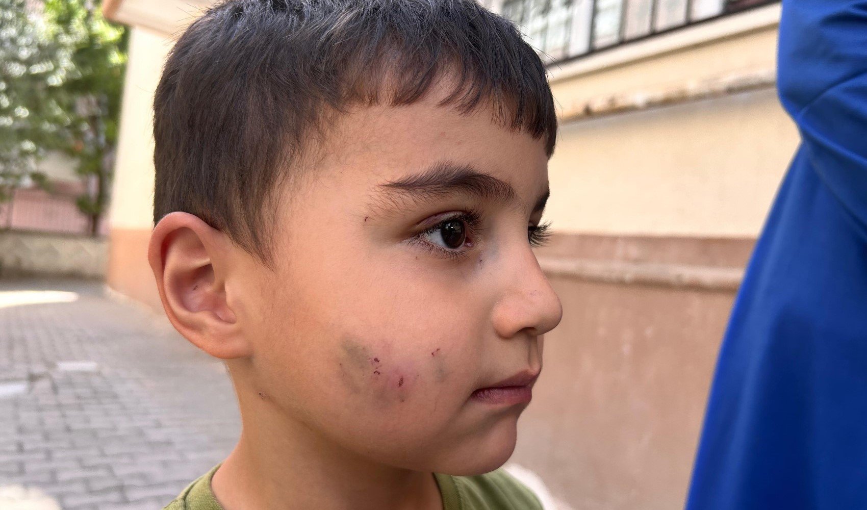 Evde uyuyan çocuğu lağım faresi ısırdı: Yüzünden kanlar akıyordu