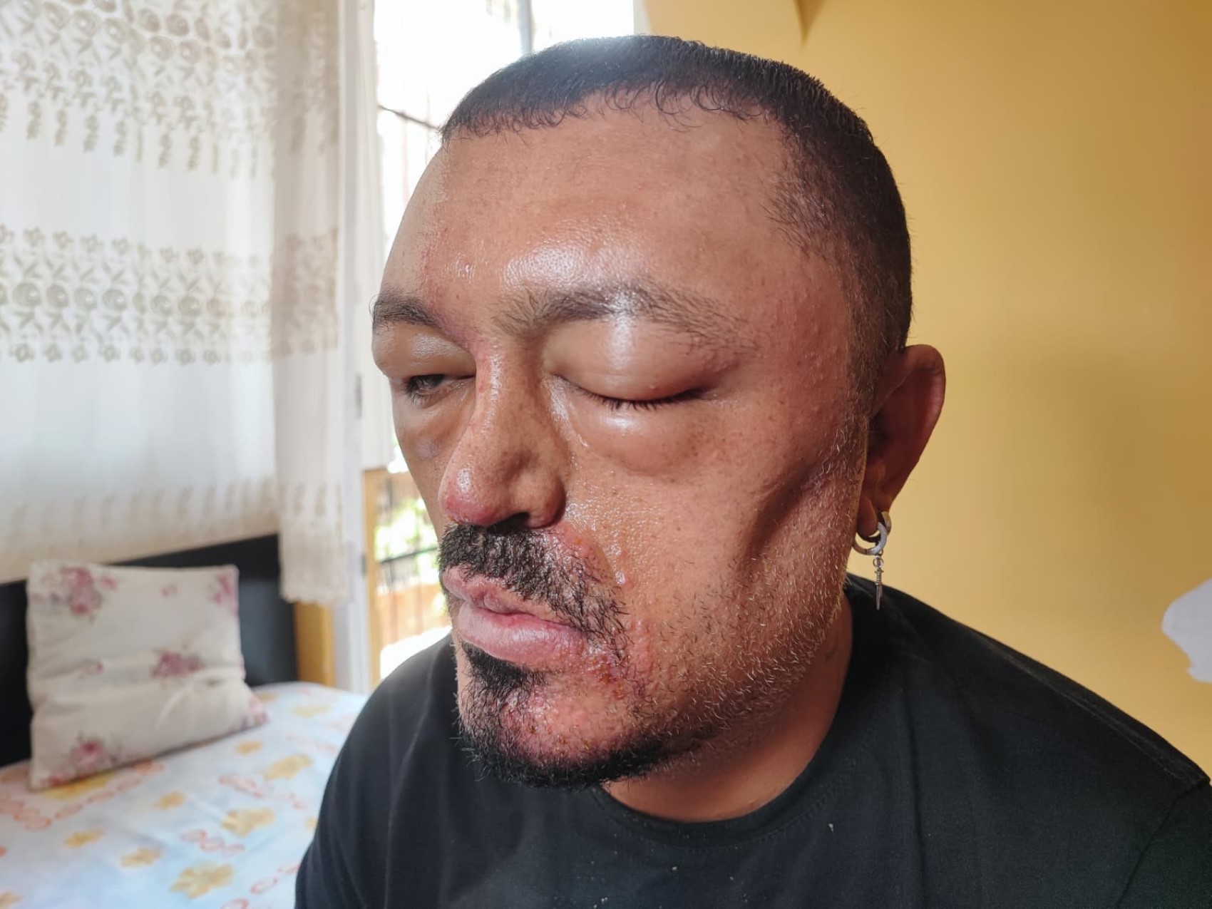 Saçları kararsın istedi, hayatı karardı