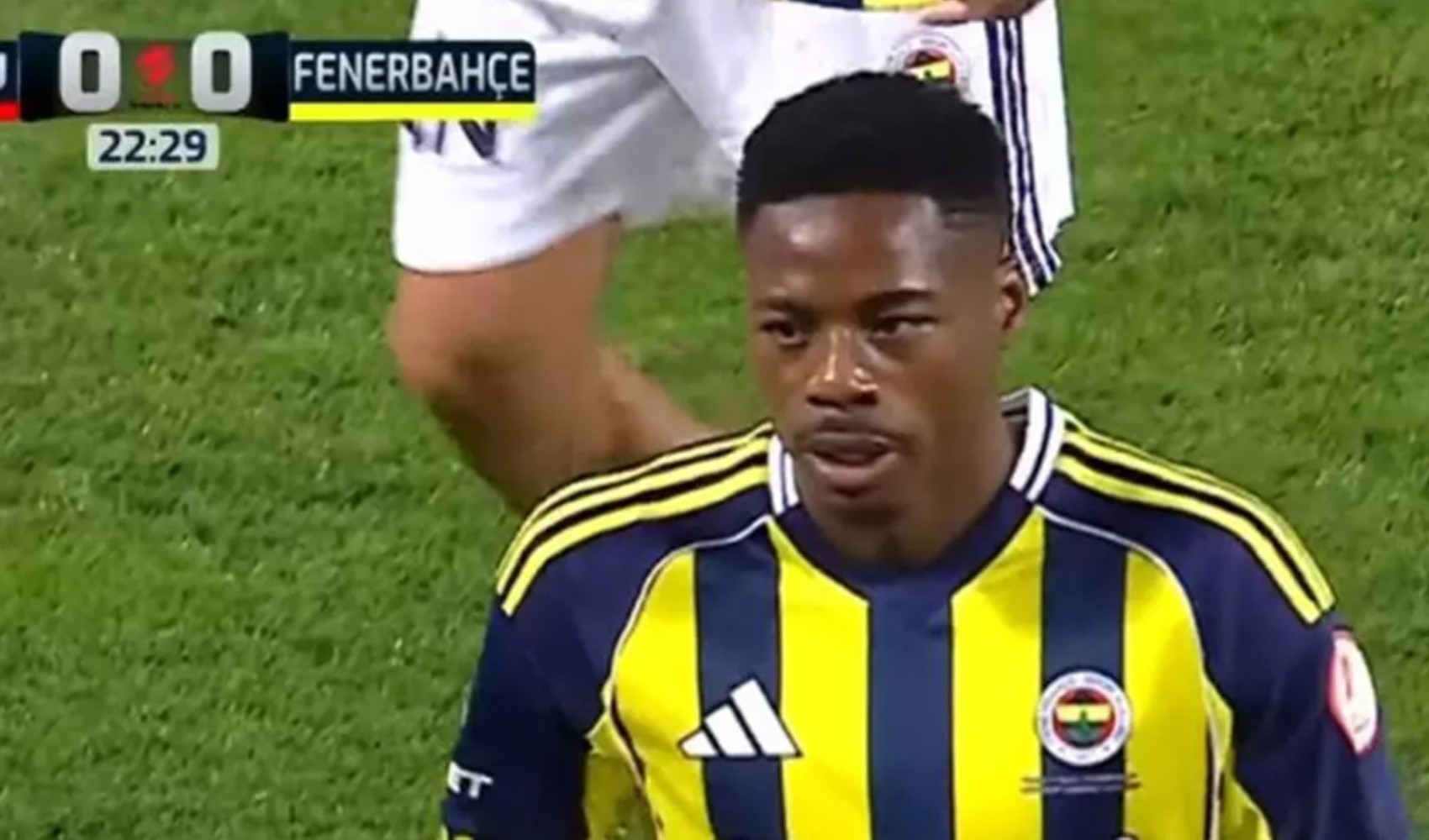Fenerbahçe'nin yeni transferi Musaba sakatlandı