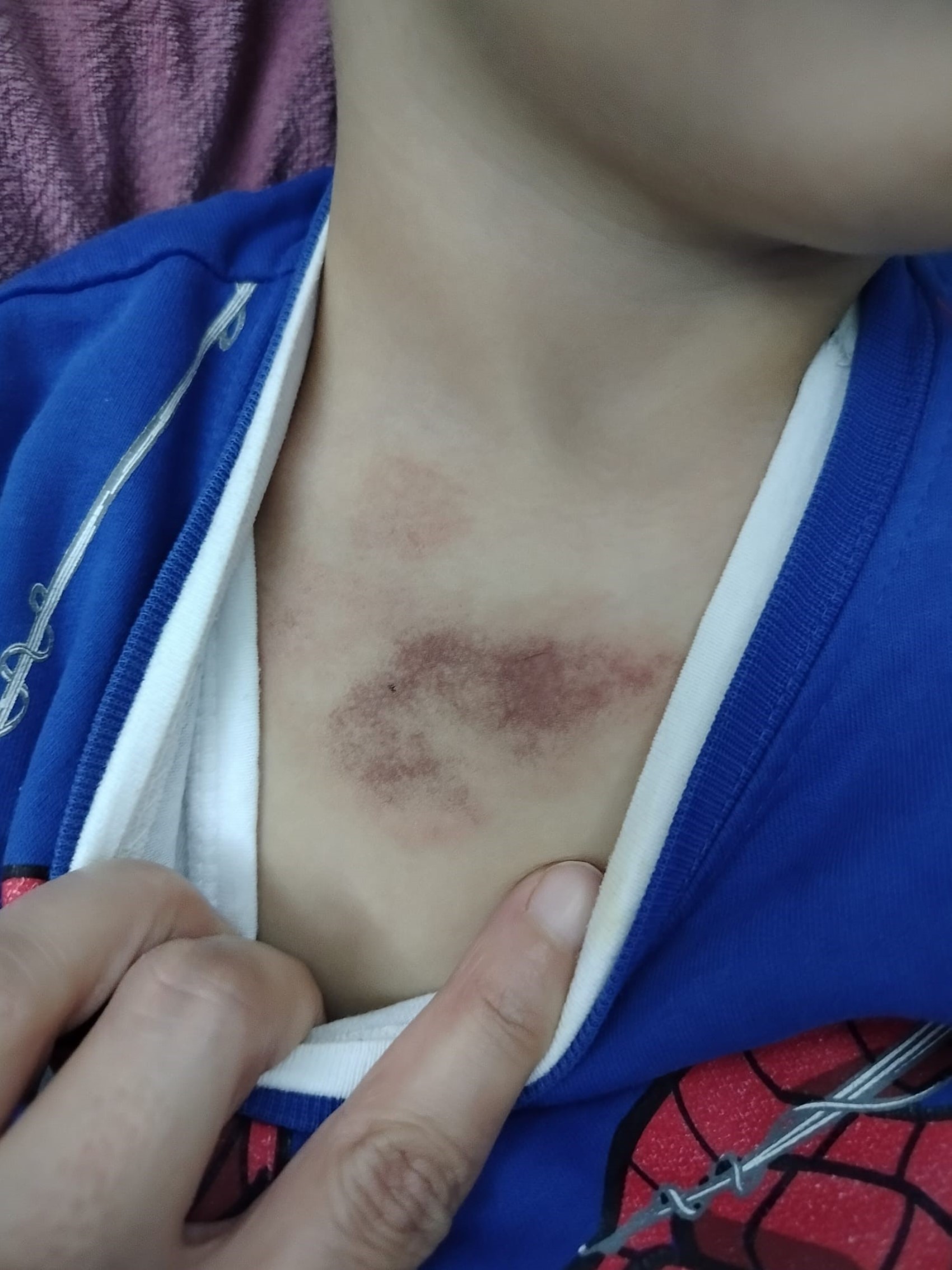 İBB kreşinde istismar ve darp iddiası