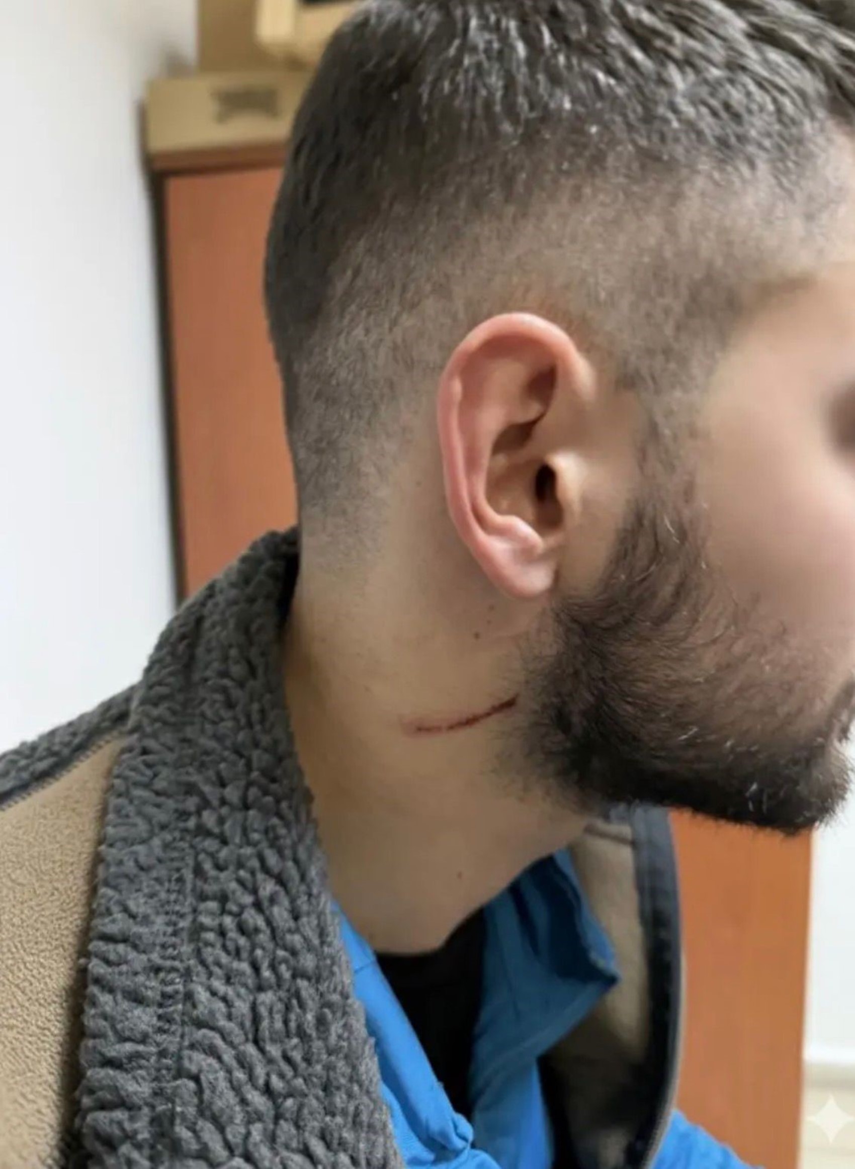 Kartepe'deki kavganın en büyük mağduru çocuklar oldu: Babama 5 kişi saldırdılar, kafasını ATV'ye vurdular