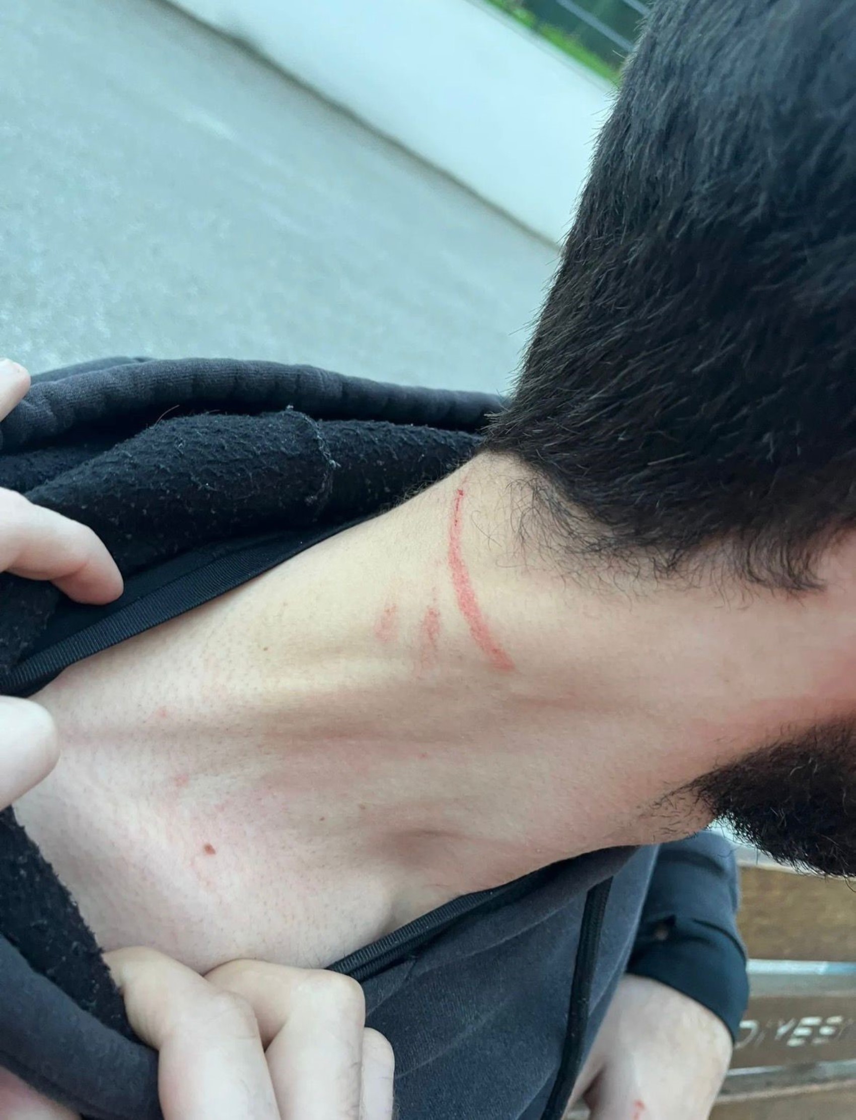 Kartepe'deki kavganın en büyük mağduru çocuklar oldu: Babama 5 kişi saldırdılar, kafasını ATV'ye vurdular