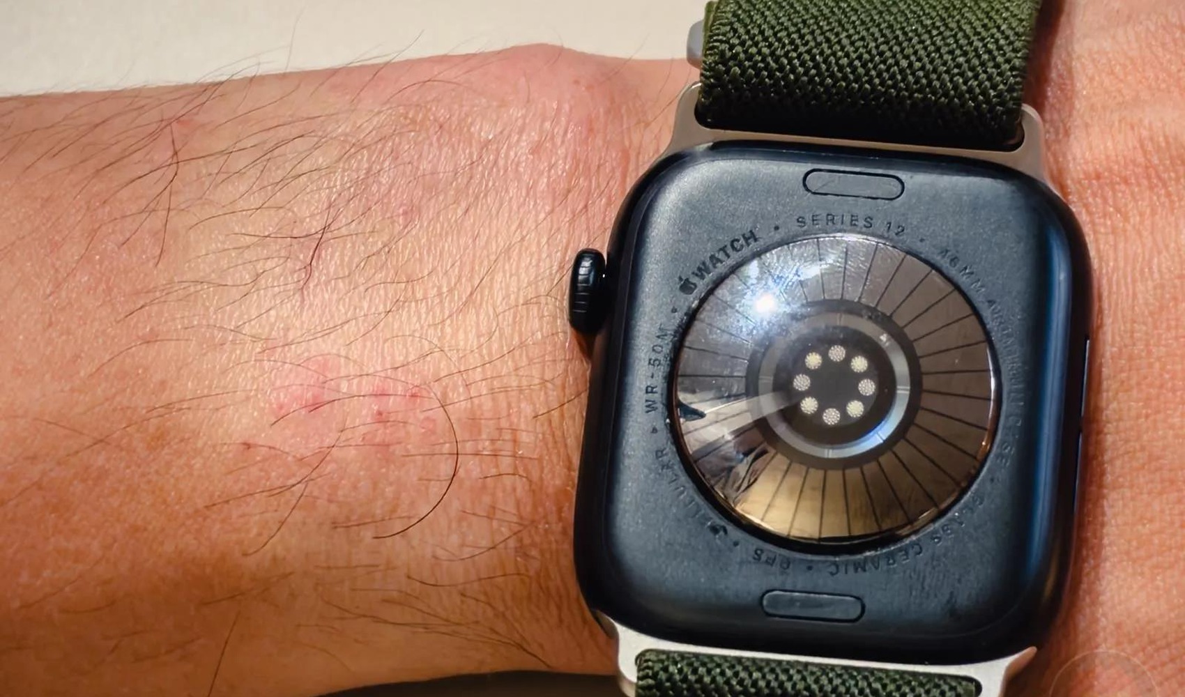 Yeni Apple Watch modellerinde cilt tahrişi şikayetleri gündemde